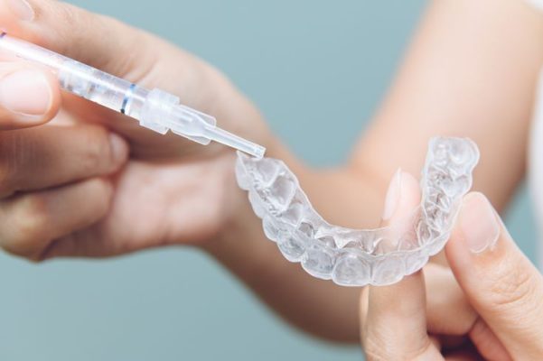 Peróxido de carbamida: La clave para una sonrisa radiante - Odontologicos