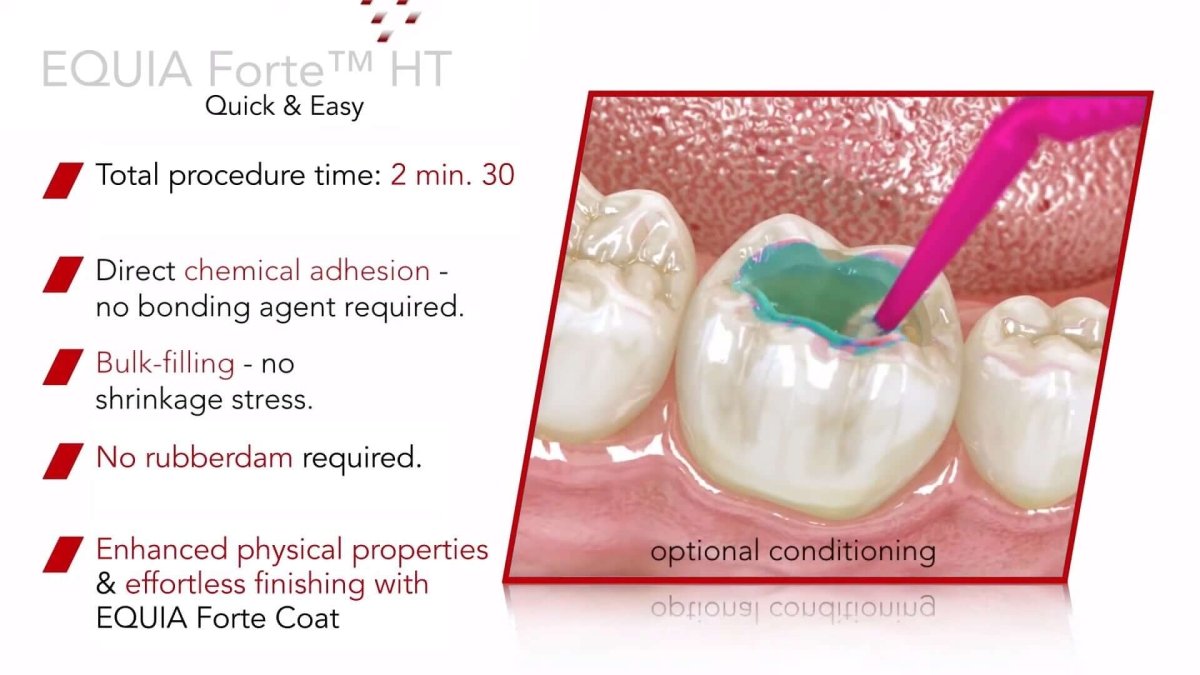 Equia Forte HT Ionómero de vidrio - GC - Odontologicos