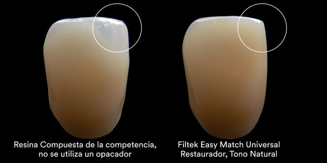 Filtek Easy Match - Composite Universal Camaleónico - Solventum 3M - Odontologicos