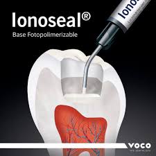 Ionoseal. Ionómero de vidrio (3jer x 2,5gr) - VOCO - Odontologicos