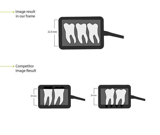 Sensor Digital de Rayos X HDR 500 BADER®️ DENTAL - Odontologicos