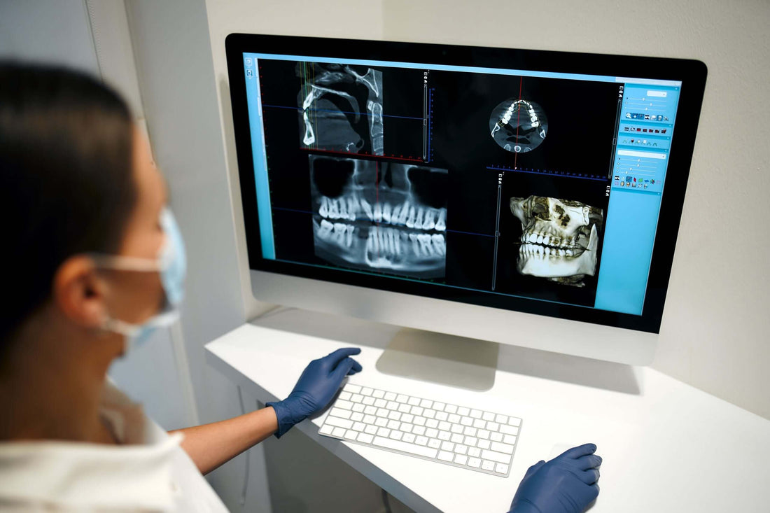 CBCT: La Revolución en el Diagnóstico Dental