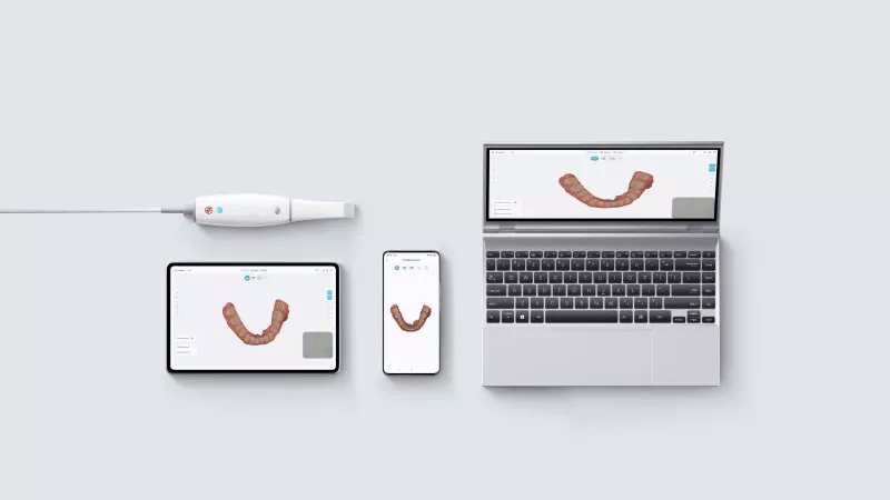 Escáner intraoral Smile Scan - KP - Woodpecker - Odontologicos